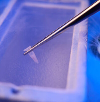 Embryo Freezing